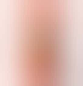 Lost Farm by KIVA - 100mg Live Rosin Gummies (10pk) - Trop Cherries (Tropical Lemonade)