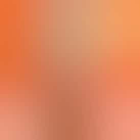 Sesh Infused Cone Pre Rolls Variety Pack (5 pack .75g/ea) - Variety Pack REC