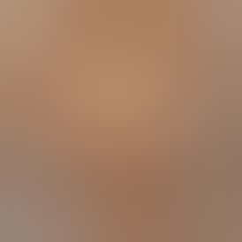 Dayglow Micron Cold Cured Live Rosin