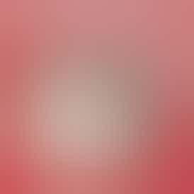 Dope Rope | 🍉💨 Wacky Watermelon | 📲📈 THE INTERNET’S FAVORITE | 200MG